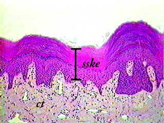 importance of epithelial tissue