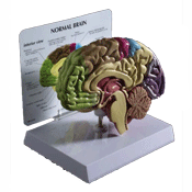 N1 - Half Brain