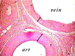 Artery and Vein, c.s