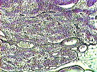 051 Vintage Microscope Slide Wards Reticular Tissue 93-3236 
