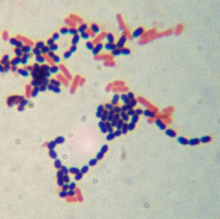 why will old gram positive cells stain gram negative